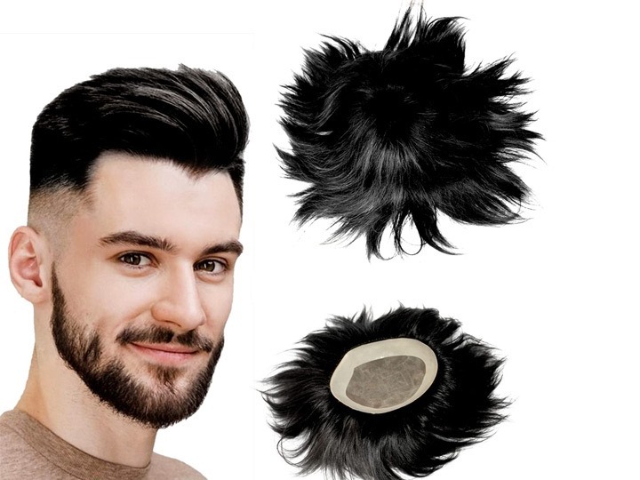 Common Hair Patch Side Effects and How to Manage Them
