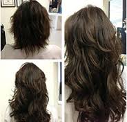 Non Surgical Hair Replacement in Hyderabad