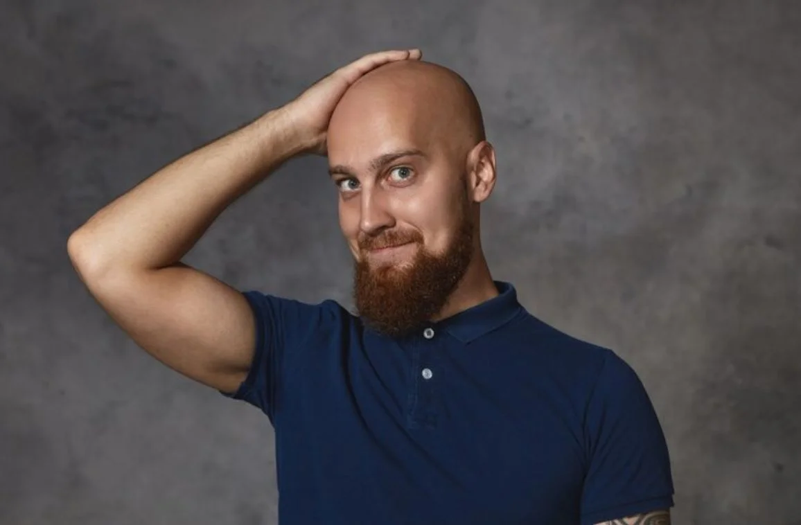 Understanding Male Baldness Causes and Prevention