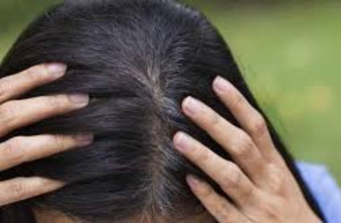 Gray Hair before 30: Common Causes and Myths