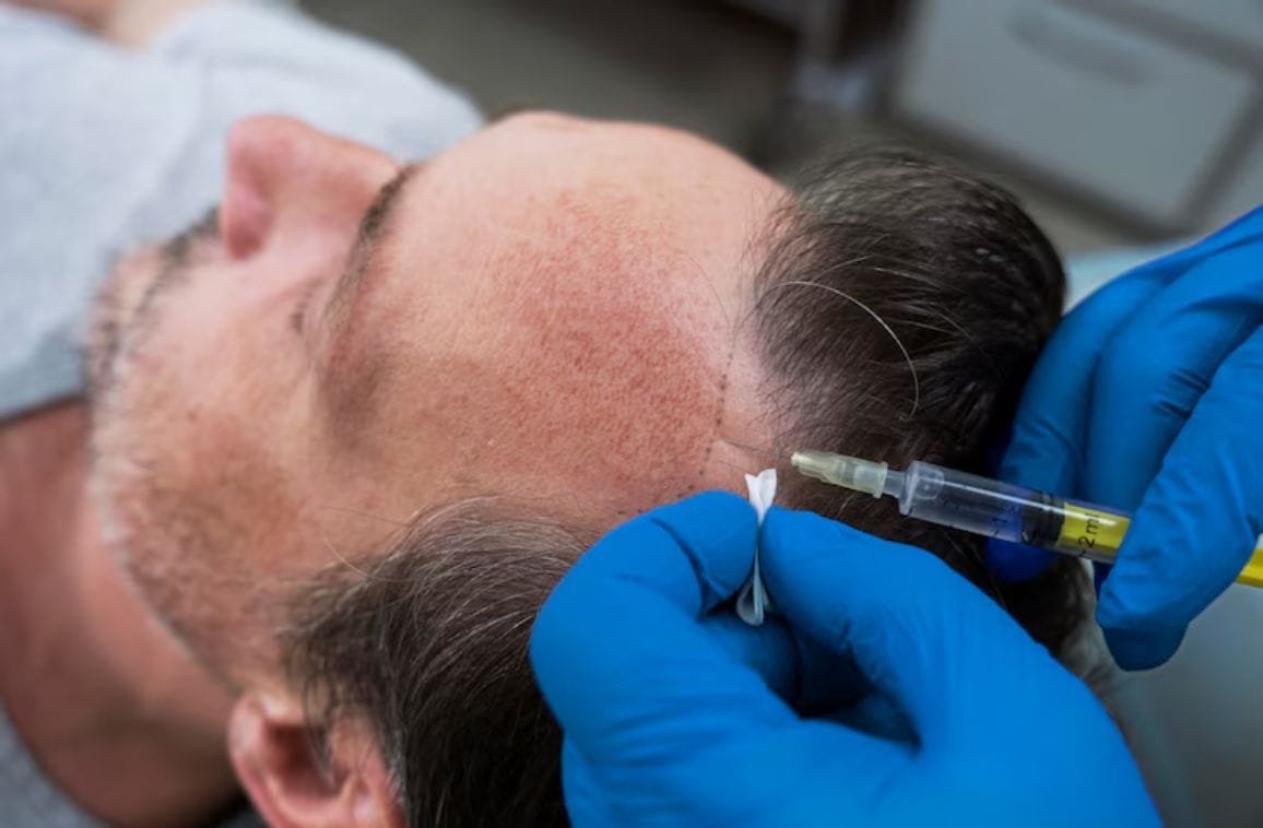 Hair Surgery Treatment: Is It the Right Choice for You?