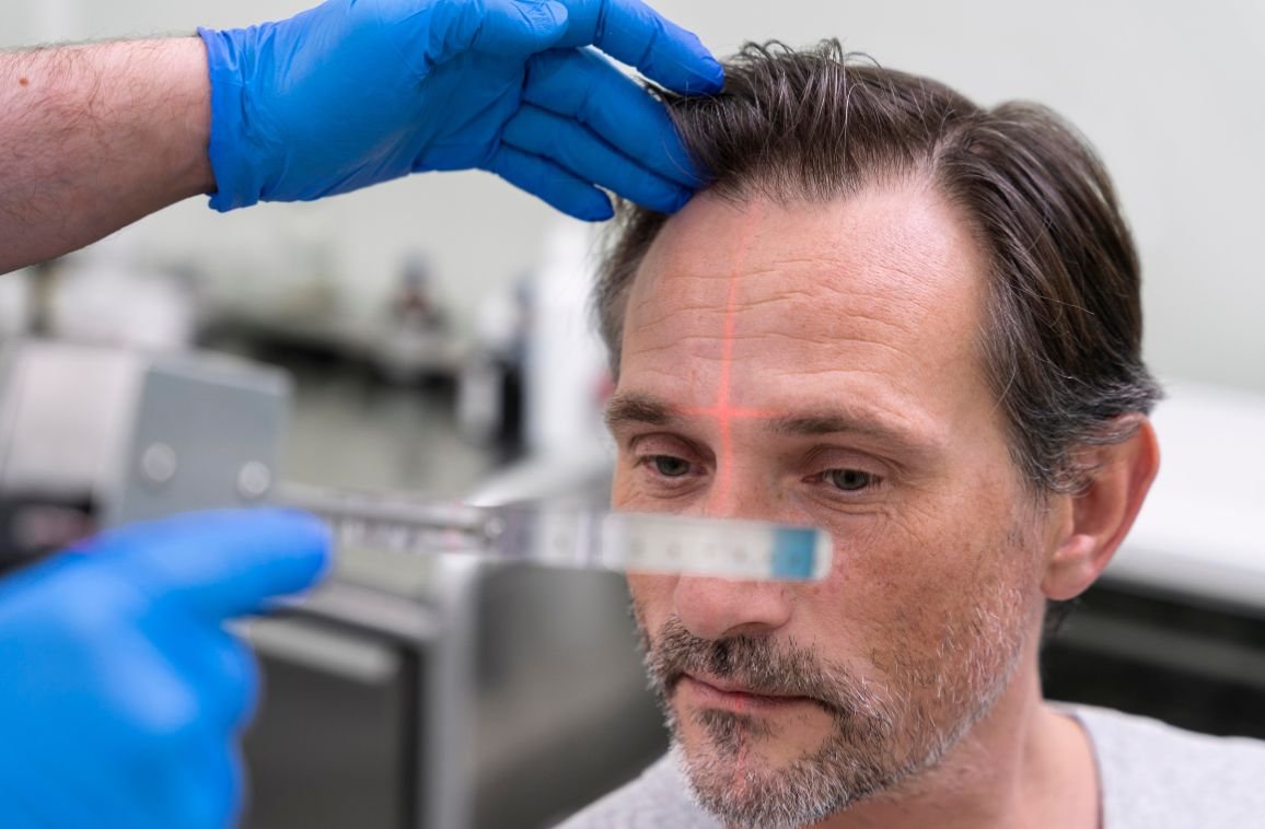 Top Benefits of Non-Surgical Hair Replacement Systems