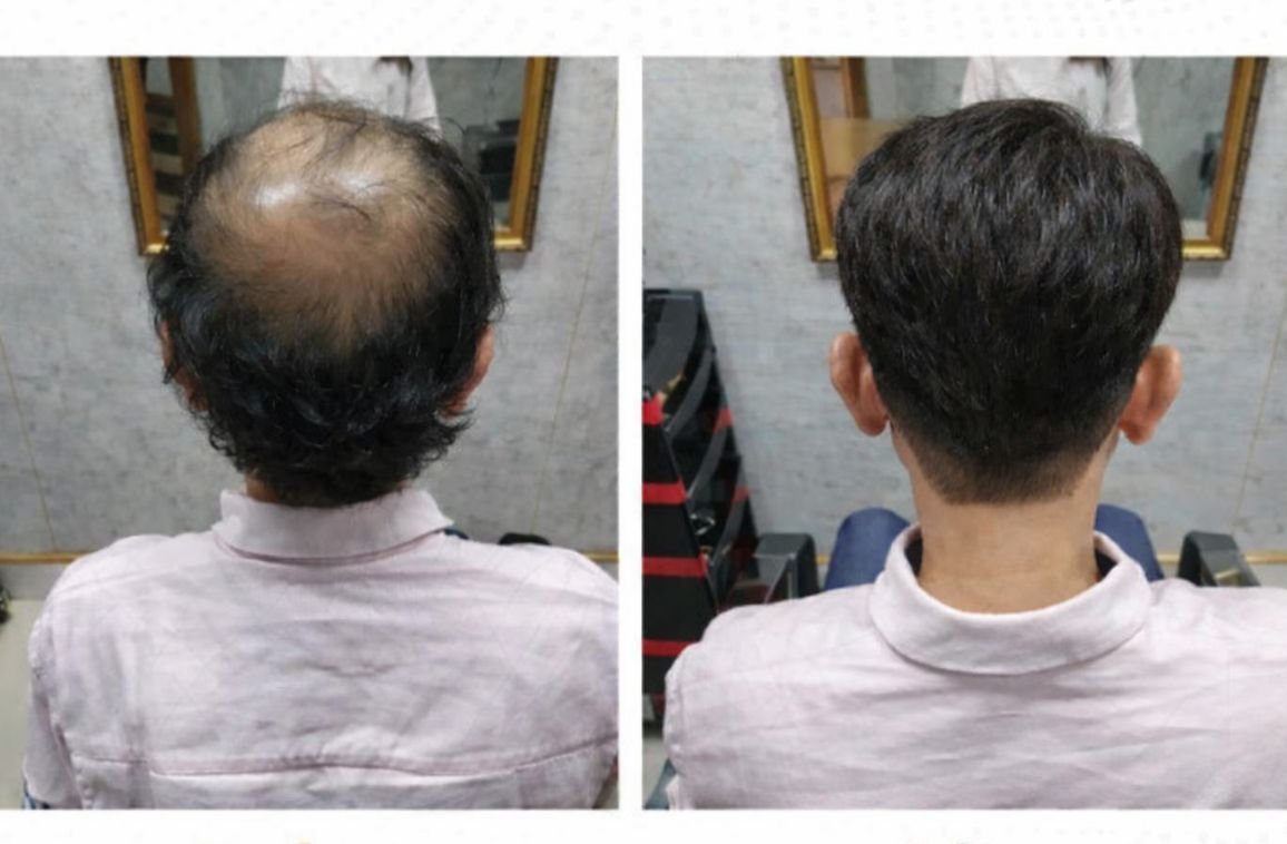 Hair Bonding Treatment: Step-by-Step Process Explained