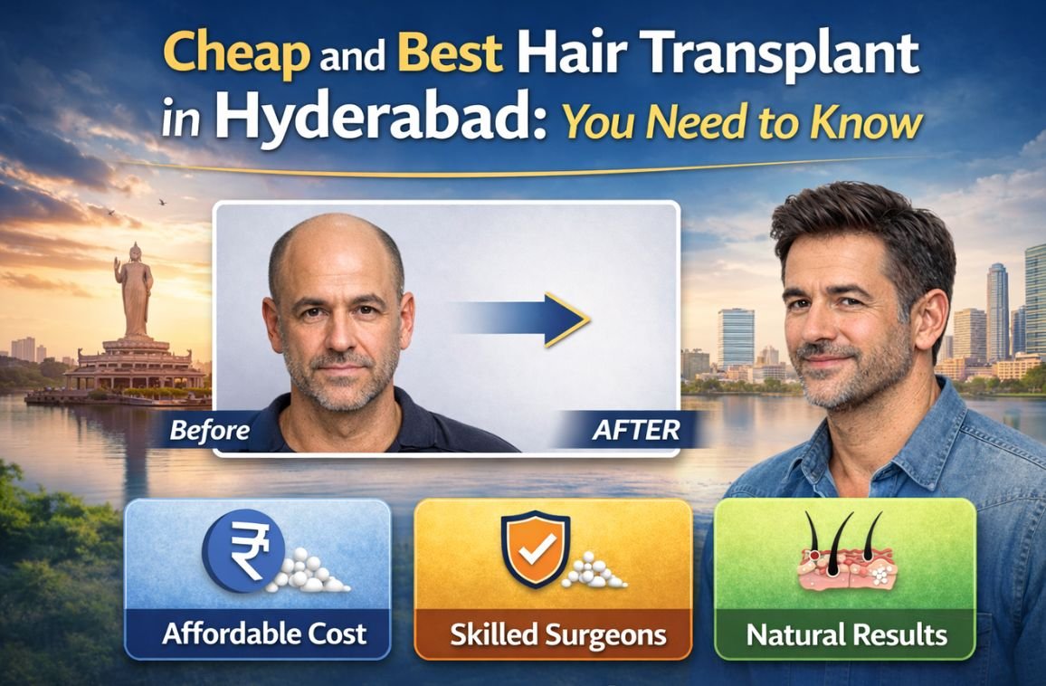 Cheap and Best Hair Transplant in Hyderabad: You Need to Know